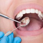 How Sherway Trillium Dental Handles Emergency Tooth Extractions & Repairs