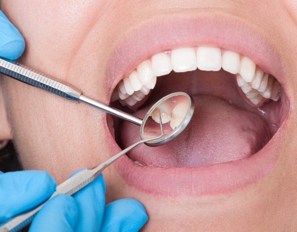 How Sherway Trillium Dental Handles Emergency Tooth Extractions & Repairs